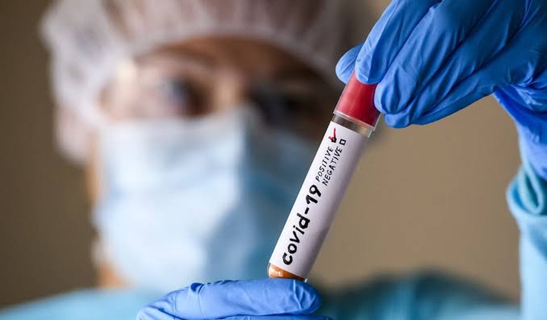 Alagoas chega a mais de 68 mil casos confirmados e 1.688 óbitos por Covid-19