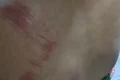 Com ciúmes, homem dá soco em companheira e tenta matá-la estrangulada em Piaçabuçu