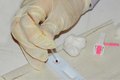 Sesau abre inscrições para o Curso sobre as Diretrizes de Diagnóstico do HIV, Hepatites e Sífilis