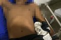 Suspeito de envolvimento no assassinato de sargento reformado dá entrada no HGE com perfuração em perna