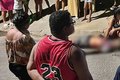 Homem sofre atentado a tiros após discussão em São Miguel dos Campos