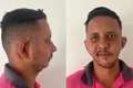 Homem alvo de piada de Carlinhos Maia espera há mais de 10 anos por cirurgia de R$ 471 mil