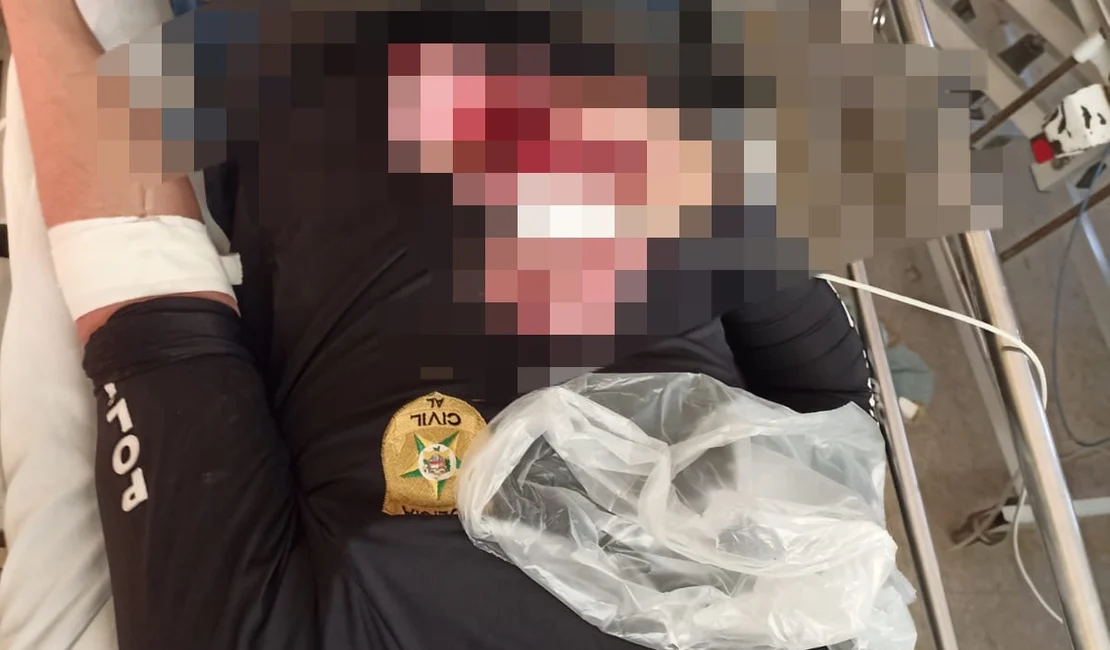 Filho de fazendeiro alagoano que teria encomendado e comemorado a morte do pai reage à prisão e atira em policial civil