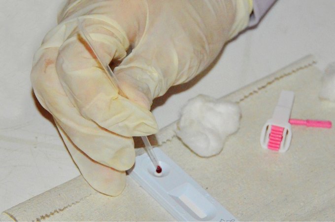 Sesau abre inscrições para o Curso sobre as Diretrizes de Diagnóstico do HIV, Hepatites e Sífilis