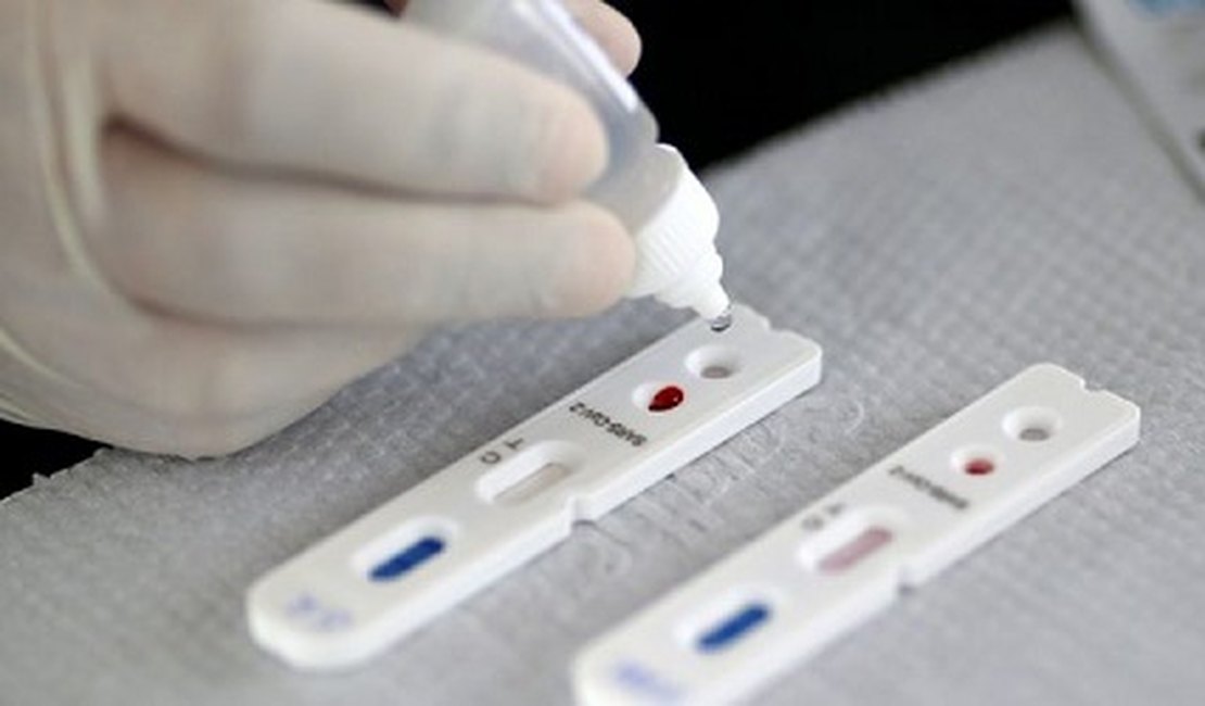 Estudo observa que anticorpos em pacientes recuperados de Covid-19 diminuíram rapidamente