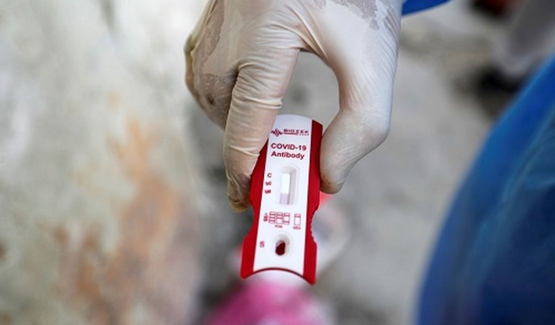 Com mais 857 infectados, Alagoas soma 36.819 casos positivos de Covid-19