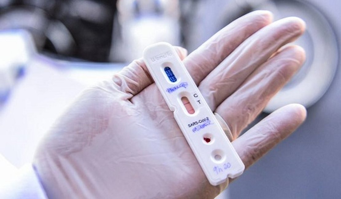 Boletim da Covid-19 em Arapiraca: 102 novos casos e um óbito