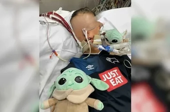 Jovem que achava ter gripe descobre quadro grave e perde as 2 pernas
