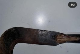 Após descobrir suposta traição, homem tenta matar a esposa com golpes de foice em Palmeira dos Índios