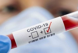Covid-19: 3.513 alagoanos ainda estão em isolamento domiciliar