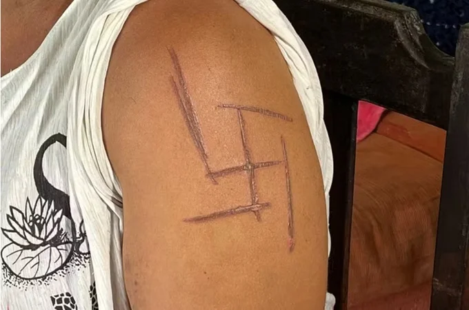 Mulher trans é torturada e marcada com suástica nazista no Mato Grosso do Sul