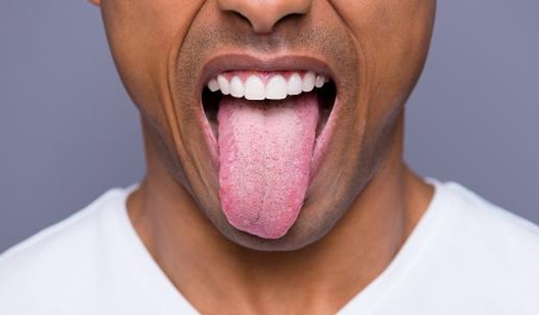 12 sinais de alerta na língua que jamais deve ignorar