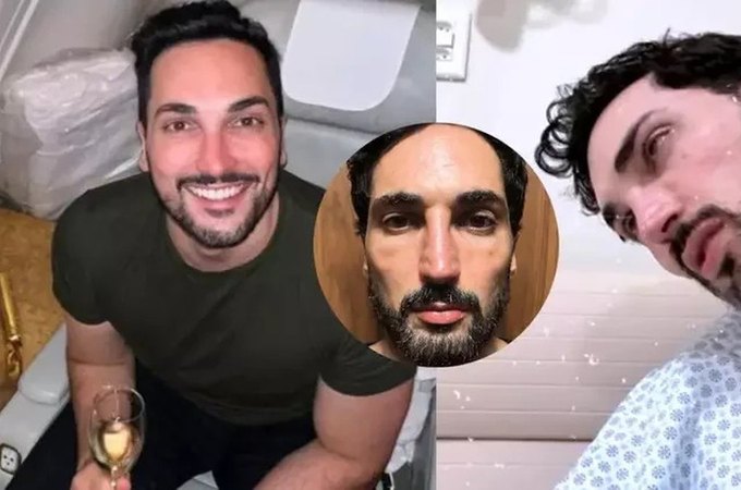 Influencer fica com o rosto 'derretido' após usar Mounjaro e faz alerta