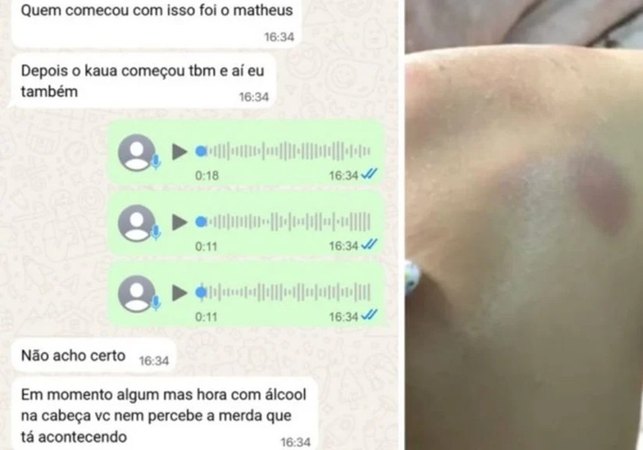 Adolescente de 17 anos denuncia estupro coletivo em churrasco com amigos em MG