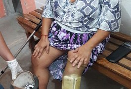 Mulher é presa durante visita no presídio com celulares e drogas escondidos em prótese de perna