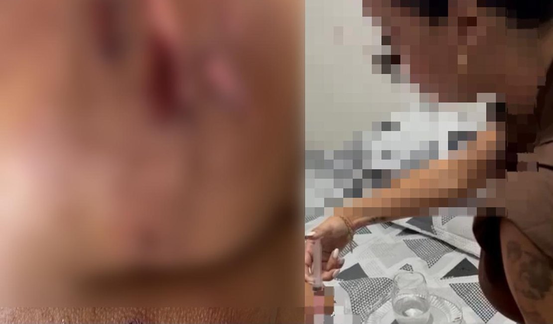 Dentista que usou silicone industrial e provocou lesão em pacientes é presa pela Polícia Civil, em Arapiraca
