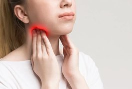 Linfoma: 5 mitos sobre o câncer do sangue que você precisa conhecer