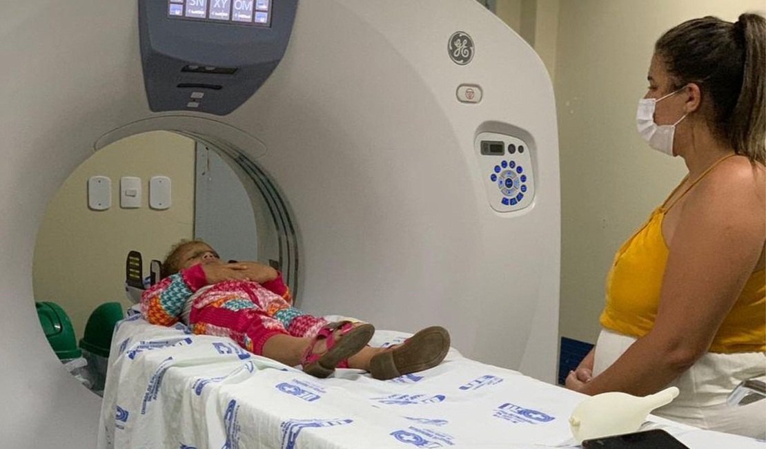 Estado irá custear tratamento de menina arapiraquense vítima de acidente