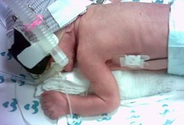 Bebê de cinco meses consegue tratamento cardiopediátrico em Recife