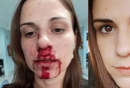 Mulher acusa ex-marido de agressão e posta foto com rosto ensanguentado