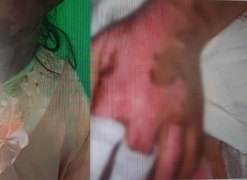 Polícia Civil investiga tentativa de feminicídio, por esganadura, contra adolescente de 16 anos, no Sertão alagoano