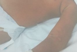Criança de 2 anos agredida pelos tios é transferida para UTI Pediátrica do HGE