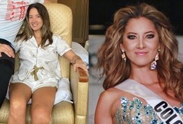 Miss Colômbia 2012 tem perna amputada após complicações em cirurgia de rotina