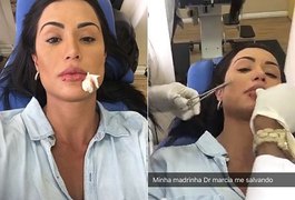 Brincadeirinha! Gracyanne Barbosa é mordida por cão de estimação