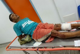 Radiopatrulha flagra tentativa de assalto, suspeito reage e é atingido na perna