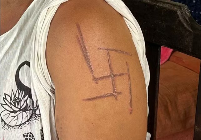 Mulher trans é torturada e marcada com suástica nazista no Mato Grosso do Sul