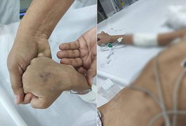 Morre no hospital a menina de 5 anos que teria sido espancada por pai e madrasta em São Miguel dos Campos