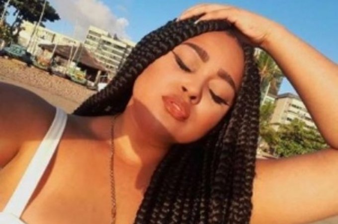 Ex-BBB alagoana sofre acidente com moto elétrica e revela fratura no olho