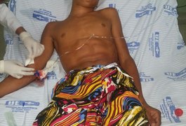 Menor é alvejado a tiros no bairro Bonsucesso, em Arapiraca