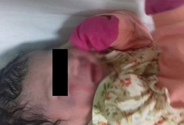 Bebê nasce com manchas roxas na cabeça e família questiona procedimento de parto