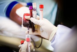 Tipo sanguíneo e genes estão ligados à covid-19 grave, mostra estudo europeu