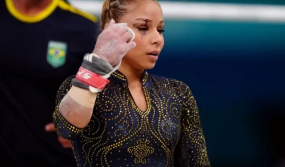 Flavinha sofre queda e corta supercílio na final da ginástica