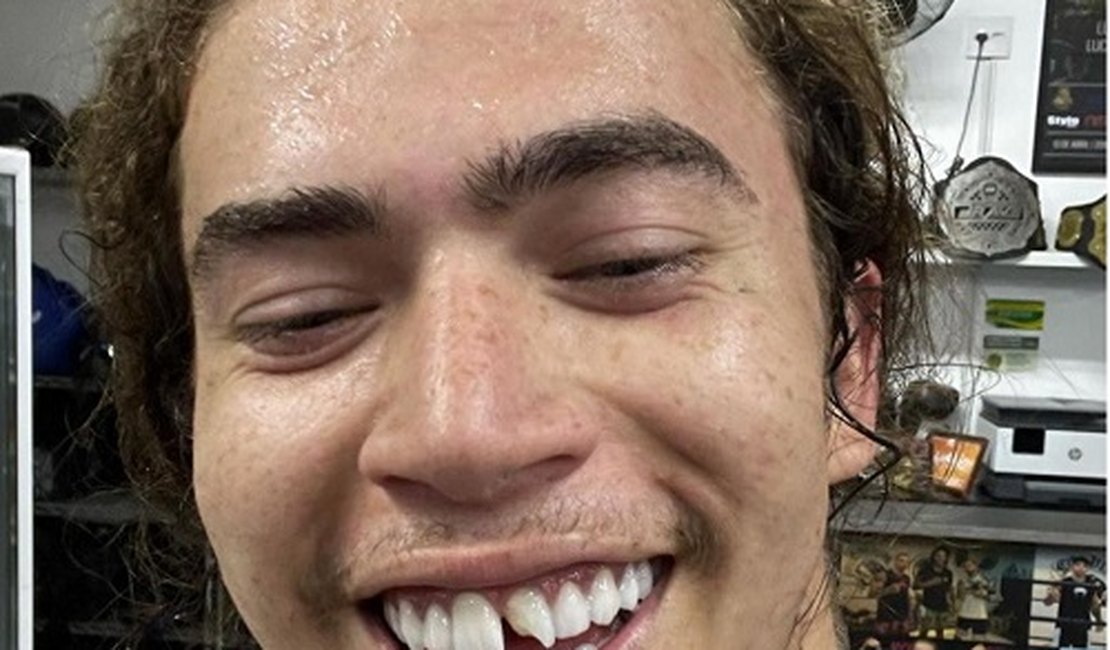Whindersson Nunes arrebenta dente da frente durante treino e compartilha: 'Vacilei'
