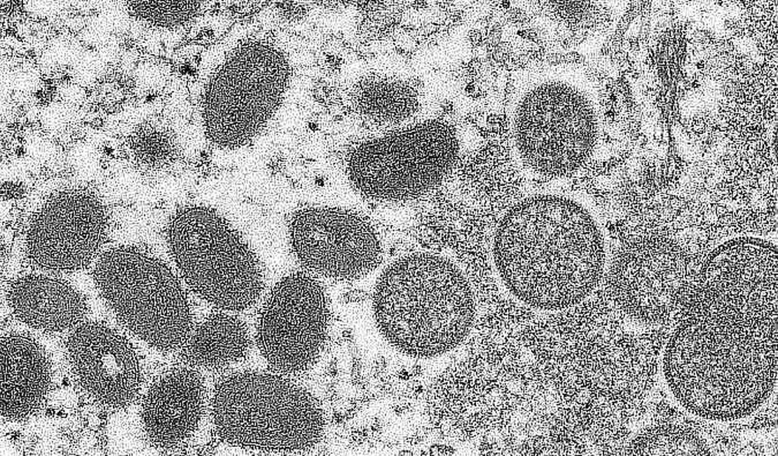 Sobe para 34 o número de casos em investigação de varíola dos macacos em Alagoas