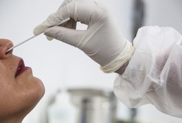 Planos devem autorizar RT-PCR de forma imediata