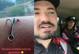 Cantor sertanejo acaba com anzol preso no braço após dia de pescaria