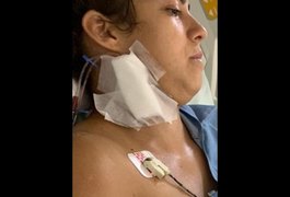 Irmãs são internadas após comerem peixe e adquirirem a doença da urina preta