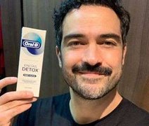 Fãs 'perdoam' Alfonso Herrera por não aceitar live RBD e apontam deboche em post