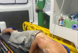 Com o corpo em chamas, homem acusa esposa de tentativa de homicídio