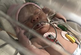 Bebê arapiraquense com apenas 3 dias de vida luta pra sobreviver e família pede ajuda para custos