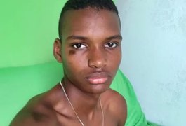 Jovem motociclista morre na AL-420 após atingir cavalo solto na pista