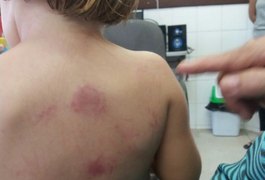 Criança é deixada em creche de Maceió e volta pra casa com marcas de violência