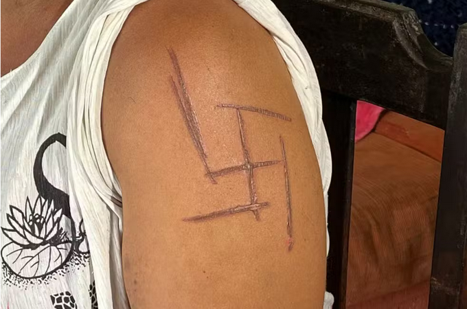 Mulher trans é torturada e marcada com suástica nazista no Mato Grosso do Sul