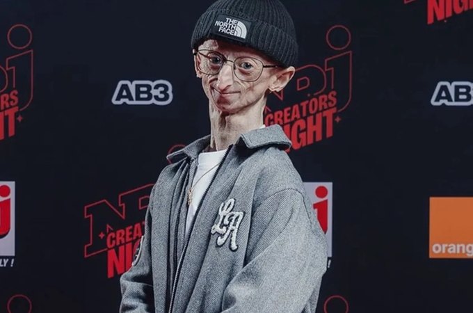 Morre, aos 28 anos, influenciador com doença genética rara
