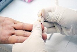 Hospital  registra cerca de 10% de casos positivos de HIV