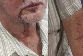 Idoso é agredido por vizinha após reclamar de som alto